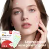 Parche para Acné Life Girl Star Amigable con la Piel Transpirable Limpieza Piel con Acné Eliminación Suave de Acné Herramienta de Belleza Transfronteriza