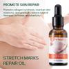 Aceites Esenciales Hidratantes Corporales y Abdominales Kormesic Fabricantes de Comercio Exterior Transfronterizo Venta al por Mayor
