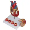 Pnt-0724 Modelo de Corazón 4 Etapas Vaso Sanguíneo Patología Arterial Anatomía Cardíaca Cardiovascular Pantalla Materiales Didácticos