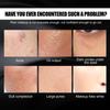 Luna Este Crema Clara para Maquillaje Ligero Ocultador de Imperfecciones Cicatrices de Acné Manchas en la Piel Crema de Belleza Hidratante para Piel Perezosa