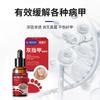 Medicina chinesa medicina onicomicose especial líquido superfície da unha espessamento brilhante unha cinza unha líquida macia solução de cuidados com as unhas geração cabelo