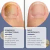 Gotas para el Cuidado de las Uñas de los Pies, Hidratantes y Cómodas, Cuidado para el Lecho Ungueal, Iluminan las Uñas de los Pies, Fórmula Suave, Gotas de Cuidado Diario