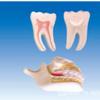 Cabello Liso de Fábrica ZM1050 Modelo de Dentición y Molienda Enseñanza Puntual Modelo de Anatomía Médica Modelo de Enseñanza Médica