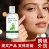 Gel de Aloe Vera para Comercio Exterior y Ventas Transfronterizas, Multiusos, Adecuado para Usar en Todo el Cuerpo, Gel de Aloe Vera Natural para Humectar e Hidratar, Completamente en Inglés