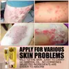 Crema reparadora de piel transfronteriza manchas musgo manchas de sudor ungüento tópico crema para picazón de piel venta al por mayor