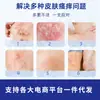 Ungüento Antibacteriano Miao Sanshu Fuleqing para Alivio de la Picazón de Uso Externo, Crema para Aliviar la Picazón de la Piel, Masaje para el Cuidado de la Salud, En Stock al por Mayor