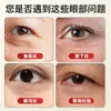 Masajeador Facial Pequeño de Loto, Belleza Facial, Palillo para Estirar Ojos, Herramienta de Cuidado de la Piel para Puntos de Acupuntura, Estilo Igual a Xiaohongshu Venta al por Mayor