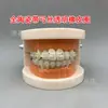 Modelo ortodôntico dental modelo autoligante de cermet oral display de comunicação médico-paciente ambulatorial modelo dental de ensino
