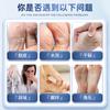 Medicina chinesa Hanfang creme para escalda-pés acônito para homens e mulheres escalda-pés sudorese nos pés pés secos bolhas descamação spray para escalda-pés atacado