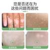 Líquido condicionador de leucodermia com psoraleno de Lao Chen Fang para aliviar manchas de suor de leucodermia causadas pela fonte de desconforto físico fabricantes