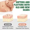 Hojas de Silicona Transfronterizas para Cicatrices, 1.5m de Longitud, Calmante para Piel con Cicatrices, Cuerpo, Cinta de Hoja de Silicona para Cicatrices