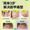 Pegatinas para Corrección de Uñas Encarnadas, Almohadillas Adhesivas para Corrección y Estiramiento del Surco Ungueal Sin Adhesivo, Almohadillas para Uñas de los Pies, Pegatinas para Corrección de Uñas