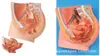 Modelo Anatômico do Útero Modelo: Yj/Sz0009 Material de PVC Modelo do Sistema Reprodutor do Corpo Humano