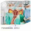 Modelo uterino patológico femenino Obstetricia y ginecología femenina Simulación de la anatomía de la estructura uterina Modelo uterino enfermo