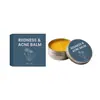 Crema de Cuidado Facial Diaria Suave Equilibrante del Aceite de la Superficie de la Piel y Limpieza del Acné Refrescante Crema de Cuidado Facial