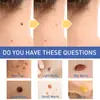 Crema Removedora de Verrugas South Moon para Piel del Cuerpo, Elimina Verrugas, Lunares Negros, Acrocordones y Callos, Limpia y Suaviza la Piel Suavemente