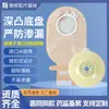 Bolsa de Ostomía de Dos Piezas Yahui con Válvula de Escape, Bolsa Desechable Transparente de Extremo Abierto para Heces en Color Piel