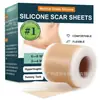 Fita de silicone para alívio de cicatrizes, adesivo para cicatrizes de pele, fita de silicone para cicatrizes - Mais vendido internacionalmente