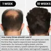 Sistema de Regeneración Capilar Kit de Ampollas Transfronterizo Introducción con Microneedling en el Cuero Cabelludo Sistema de Regeneración Capilar Anti-Caída