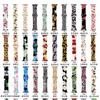 Adecuado para Apple Watch 11 Silicona Estampado Iwatch678910 Correa de Reloj Linda S12 Fabricante