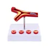 Boyou Modelo Vascular Modelo Médico Simula Modelo de Vaso Sanguíneo Humano Bloqueio de Vaso Sanguíneo Treinamento de Vaso Sanguíneo