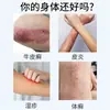 Piel de Vaca Gel Médico Antipirético Tinea Oem Procesamiento Oem Dermatitis Urticaria Húmeda Rash de Cáñamo Plateado Picazón en la Piel Crema Personalización