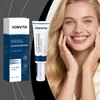 Crema para el Cuidado de la Piel Vorvita Cuida la Piel Propensa al Acné del Rostro, Dejándola Suave, Blanda y Delicada. Aplicación Diaria de la Crema