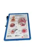 Tablero de escritura para regalos médicos al por mayor tablero de exhibición tablero de escritura médica pizarra blanca médica tablero de exhibición médica se puede borrar repetidamente