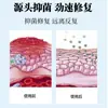 Procesamiento OEM Rey de los Hongos de Huang para el Cuidado de la Piel: Crema de Ajenjo para el Mal Olor de Pies, Pies con Picazón y Cuidado de la Piel Descamada, Personalizable