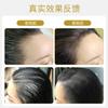 Kit de Recuperación Celular en Polvo Liofilizado para el Crecimiento del Cabello para Aumentar la Densidad Capilar y los Folículos Pilosos, Producto para el Crecimiento del Cabello ODM/OEM