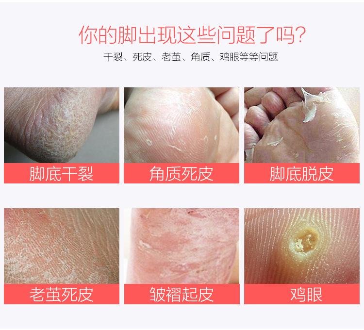8合1脚皮锉0_03.jpg