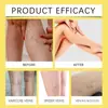 Crema para el Cuidado de las Piernas Ximonth Crema Diaria Suave para Masaje de Piernas para el Malestar en las Piernas
