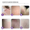 Lithospermum Limpieza de Picaduras de Piel Oem Oem Crema Antibacteriana Piel de Vaca Picazón de Piel Pomada Anti-Picazón Personalización de Puesto