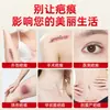 Patch para cicatriz, cobertura de tatuagem de marca de nascença, corretivo ultrafino à prova d'água e de suor, cobertura invisível para cicatrizes e tatuagens, atacado do fabricante