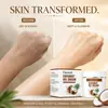 Crema de Aceite de Coco FACNURT: Hidrata la piel, calma la queratosis pilaris (piel de pollo), y proporciona fragancia duradera