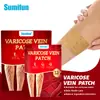 Parche Transfronterizo Sumifun para Alivio Venoso, Varices Salientes en Piernas de Lombriz, Parche para Venas de las Piernas Venta al por Mayor de Fábrica V10006
