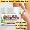 Crema hidratante para pies transfronteriza que cuida suavemente los talones, hidrata y nutre la piel de los pies, y previene la sequedad y las grietas.