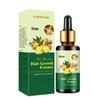 Aceite Esencial Cuidado de Jengibre Aceite Esencial Herbal para el Cuidado del Cuero Cabelludo Aceite Esencial Cuidado de Jengibre