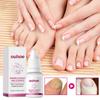 Ouhoe Esencia para el Cuidado de las Uñas de Jengibre Hidratante Exfoliante Nutritiva Uñas Dañadas Esencia para el Cuidado de las Uñas