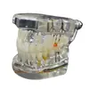 Modelo Dental Escovação Oral Prótese Dentária Boca Inteira Dental Removível Gengiva Macia Transparente Resina para Implante Preparo Dentário Molde de Dente