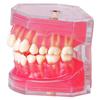 M7008 modelo de extracción dental modelo de encía blanda modelo de extracción de encía blanda