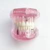 Comércio Exterior M2001 Modelo Patológico Modelo Dental Modelo de Preparação para Inlays Dentários, Modelo de Cárie, Modelo de Implante, Dentes Removíveis