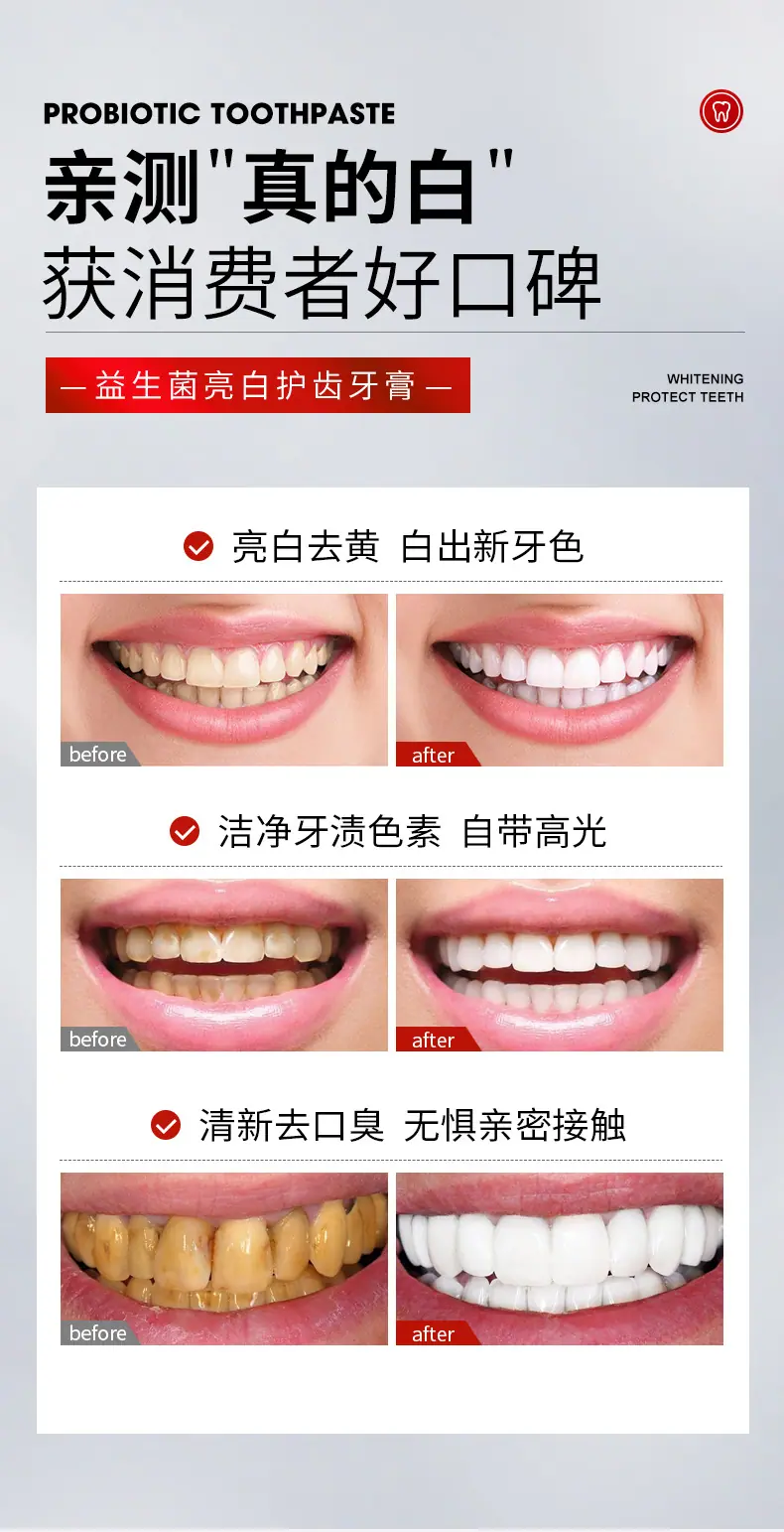 AroeMQI-SP-10益生菌亮白护齿牙膏_10