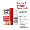 Exportación Transfronteriza Gotas para Hongos en Uñas de los Pies para Mejorar el Engrosamiento de las Uñas de Manos y Pies, Aclarar Onicomicosis y Solución para el Cuidado de los Pies