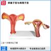 Modelo de Útero Feminino Zhenghe Estrutura Anatômica dos Órgãos Reprodutivos Internos Humano Ensino Patologia Ovariana Uso em Hospital Escola