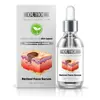 Esencia Facial de Retinol Ouhoe Hidratante y Humectante Suavizante de la Piel Facial Esencia de Cuidado Diario