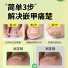 Pegado de uñas sin pegamento, corrección de surcos para uñas, parche para uñas, manicura Lala, productos de fábrica
