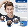 Kit de Cuidado para Alopecia Areata Transfronterizo Sumifun Yeso de Comercio Exterior al por Mayor Crema Nutricional para la Salud del Cuero Cabelludo Spray Externo