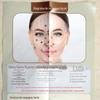 Raspagem Facial, Raspagem Ocular, Mapa de Meridianos do Corpo Humano, Quadro de Parede para Moxabustão de Pontos de Acupuntura, Quadro de Pontos de Acupuntura para Raspagem