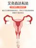 Nuevo Kit Facial Magnético Privado de Moxibustión para Ginecología Femenina Frío Uterino Perineal Moxibustión Cuidado Privado Moxibustión Salón de Belleza Catéter